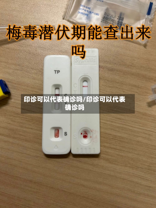印诊可以代表确诊吗/印诊可以代表确诊吗-第1张图片