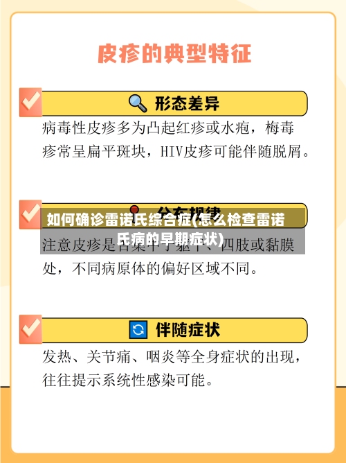 如何确诊雷诺氏综合症(怎么检查雷诺氏病的早期症状)-第1张图片
